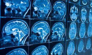Neurofeedback en individuos con altas capacidades. Técnicas y estrategias para acompañar y favorecer un correcto equilibrio de su actividad cerebral para potenciar su talento y rendimiento.