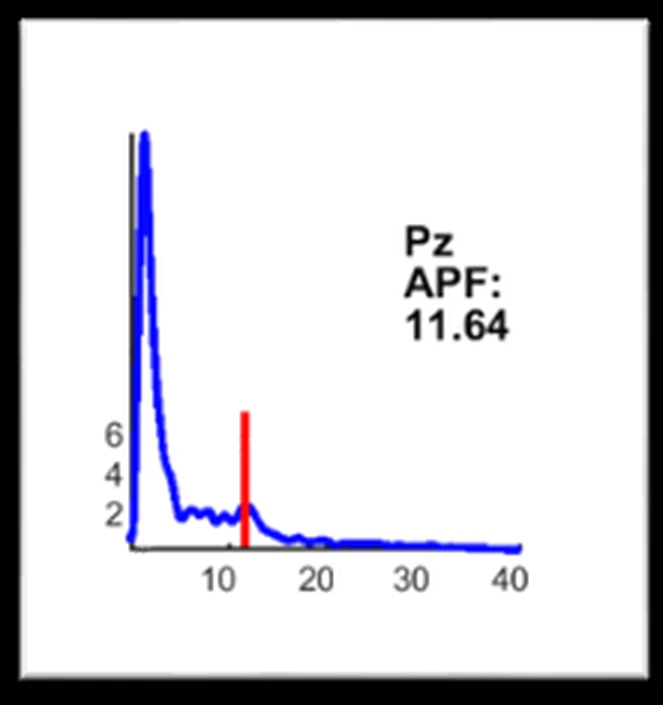 Espectro EEG en Pz con frecuencia pico alfa de 11,64 Hz en la misma clienta tras la recuperación del burnout con neurofeedback y coaching